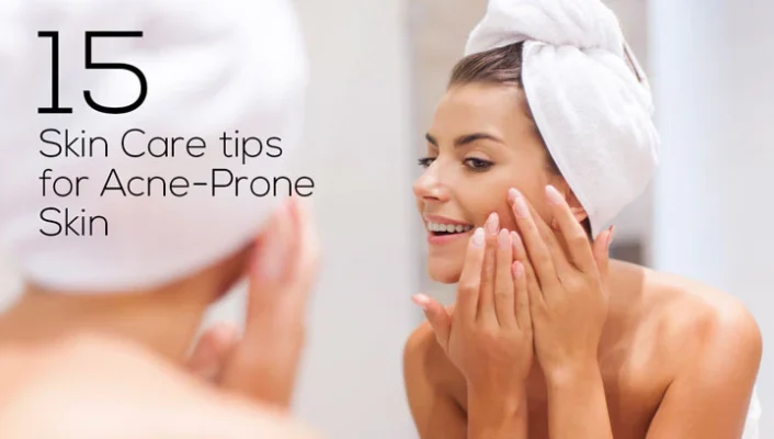 Best cosmetic products for acne-prone skin 2025. Top skincare for acne-prone skin, Non-comedogenic products 2025, Acne-prone skin care tips