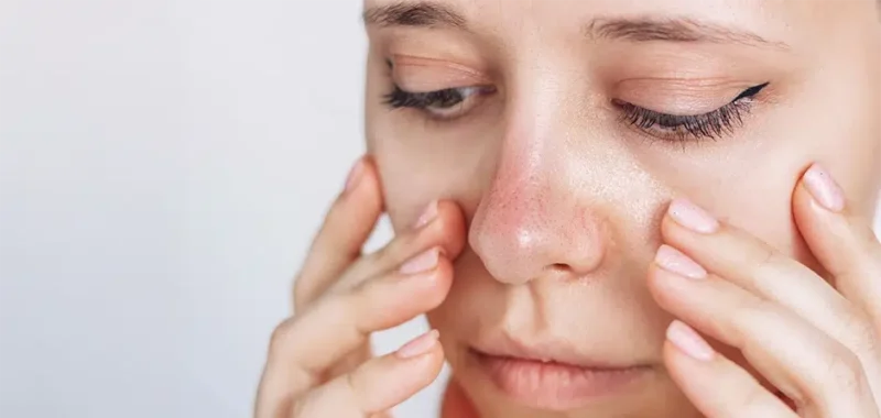 Ingredients to Avoid for Sensitive Skin